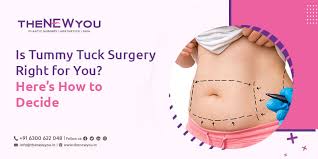 does insurance cover tummy tuck after weight loss
does insurance cover tummy tuck after c-section
does insurance cover tummy tuck after gastric sleeve
does insurance cover tummy tuck after bariatric surgery
will insurance cover a tummy tuck after ac-section
does insurance pay for tummy tuck after weight loss surgery
will insurance cover a tummy tuck after hysterectomy
does insurance pay for tummy tuck after hysterectomy
will insurance pay for tummy tuck after hysterectomy
does any insurance cover tummy tuck
does insurance cover tummy tuck for back pain
will insurance cover tummy tuck for back pain
does insurance cover tummy tuck
can your insurance cover a tummy tuck
what insurance covers tummy tucks
does insurance cover tummy tuck cost
does cigna insurance cover tummy tucks
do insurance companies cover tummy tucks
does insurance cover tummy tuck for diastasis recti
will insurance cover a tummy tuck due to diastasis recti
does insurance ever cover tummy tuck
how much does insurance cover for a tummy tuck
does insurance ever cover a tummy tuck
will insurance cover a tummy tuck after gastric bypass
does insurance cover tummy tuck with hernia repair
does health insurance cover tummy tuck
do health insurance cover tummy tuck
does husky insurance cover tummy tucks
does private health insurance cover tummy tuck
what health insurance covers tummy tucks
will insurance cover a tummy tuck if you have a hernia
will insurance pay for tummy tuck if you have a hernia
will insurance pay for tummy tuck if medically necessary
will insurance cover a tummy tuck if i have a hernia
will insurance cover a tummy tuck if i have an umbilical hernia
will insurance pay for a tummy tuck if you have diastasis recti
will insurance pay for a tummy tuck if you had a c section
does kaiser insurance cover tummy tucks
does insurance cover tummy tuck after weight loss surgery
will insurance cover tummy tuck after weight loss surgery
does insurance cover liposuction and tummy tuck
does medical insurance cover tummy tuck
will medical insurance cover tummy tuck
does insurance cover tummy tuck after pregnancy
does ppo insurance cover tummy tuck
does insurance pay for tummy tuck after c section
does insurance pay for tummy tuck surgery
insurance cover tummy tuck reddit
does insurance cover tummy tuck surgery
what insurance covers tummy tuck surgery
does unitedhealthcare insurance cover tummy tucks
does umr insurance cover a tummy tuck
